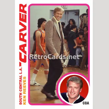 1978-79T White Shadow RetroCards Set